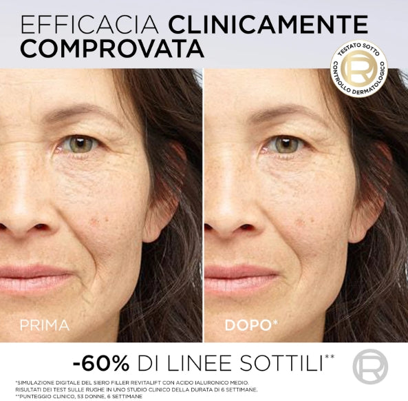 Siero Viso L'Oreal Revitalift Filler